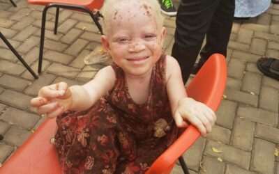 ENA Hosts "I am a Human Being"Forum to Protect Albinos