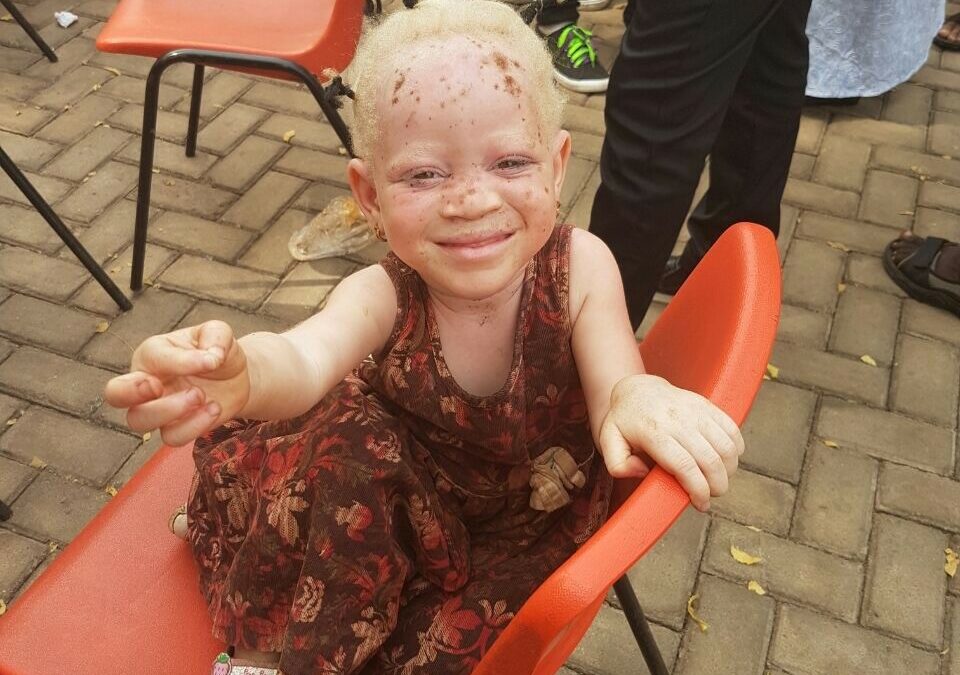 ENA Hosts "I am a Human Being"Forum to Protect Albinos